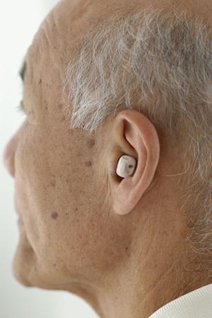 自然な歯並びを叶える！中目黒で選ばれるマウスピース矯正の最新ポイント